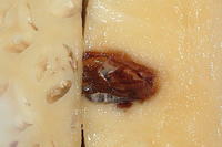 Tache noire, tache molle développée dans le fruit © Cirad